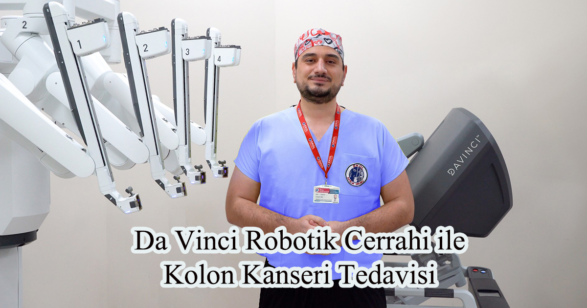 Da Vinci Robotik Cerrahi ile Kolon Kanseri Tedavisi 