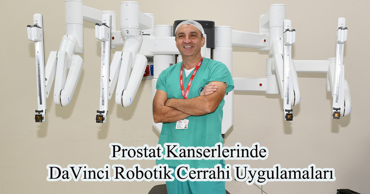 Prostat Kanserlerinde DaVinci Robotik Cerrahi Uygulamaları